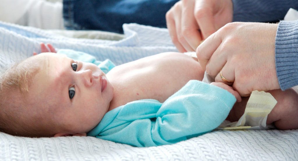 umbilical cord stump