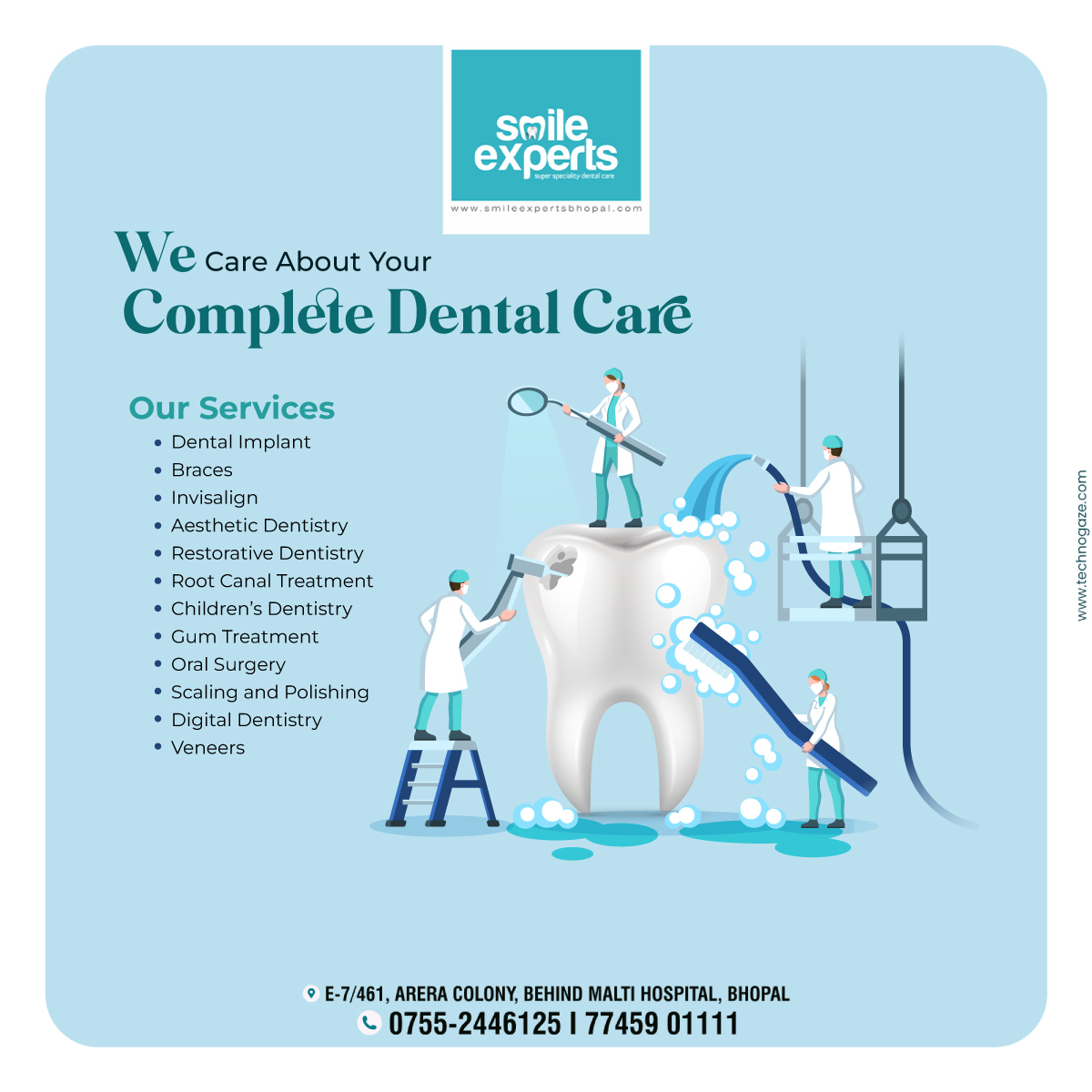 Teeth Whitening In Bhopal | Smile Experts