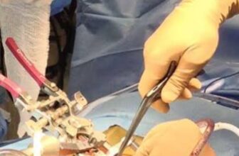 Spinal Tumor Treatment in Kolkata: Consult Top Spine Neurosurgeon in India